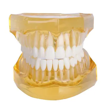 Dantų Išimami Dantų Modelio Suaugusiųjų Typodont Modelis Odontologas